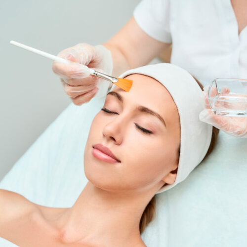 Peeling químico facial
